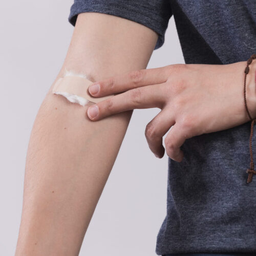 Suministro de adhesivo tisular en Costa Rica: productos de alta calidad