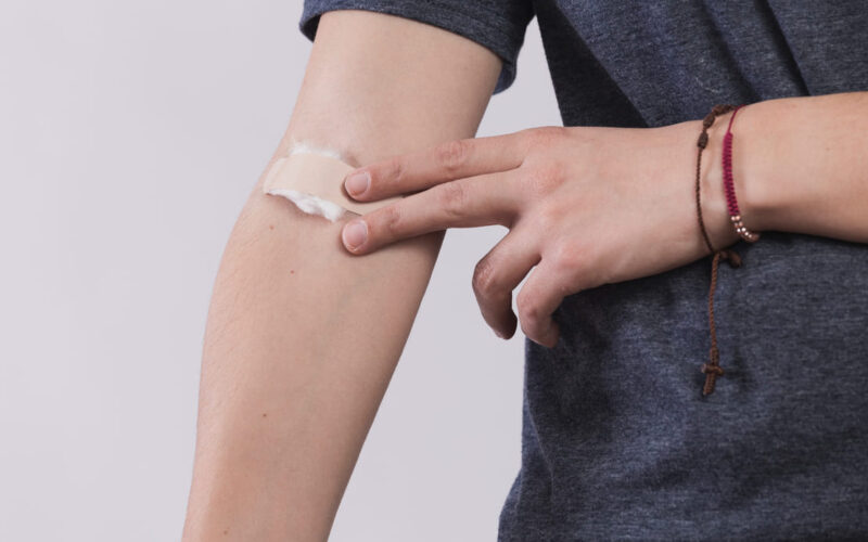 Suministro de adhesivo tisular en Costa Rica: productos de alta calidad